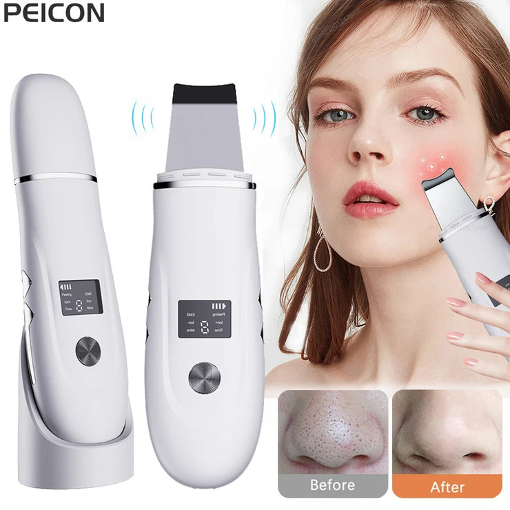 Ultrasonic Face Scrubber Facial Peeling Skin Scrubber Deep Facial Cleaning Spatula Acne Pore