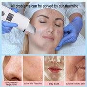 Ultrasonic Face Scrubber Facial Peeling Skin Scrubber Deep Facial Cleaning Spatula Acne Pore