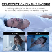 Stop Snoring Patch Nose Breathing Correction Improve Sleeping Promoting Better Breath