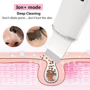 Ultrasonic Face Scrubber Facial Peeling Skin Scrubber Deep Facial Cleaning Spatula Acne Pore